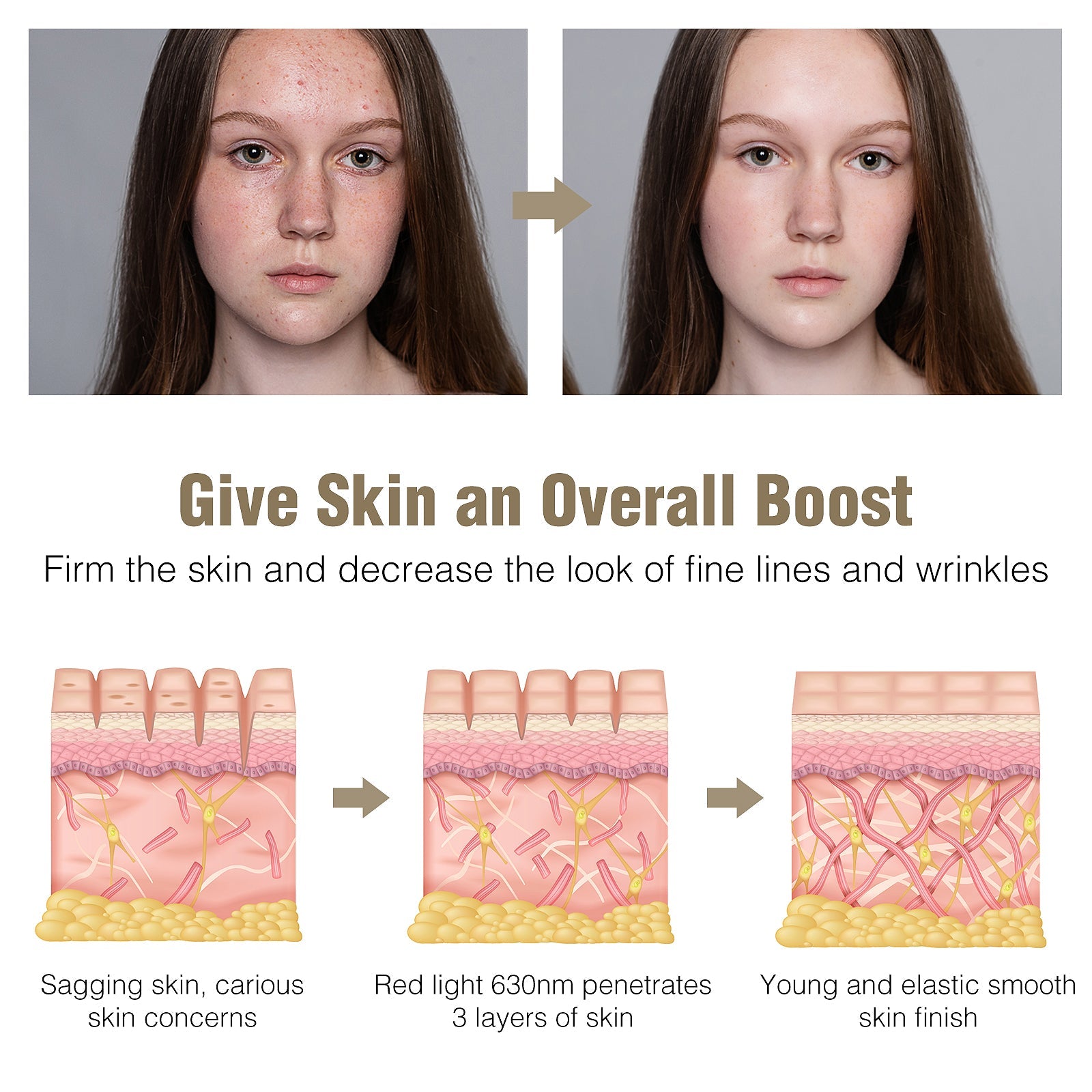 Before and after comparison of a person's face with text and diagrams about skin improvement.